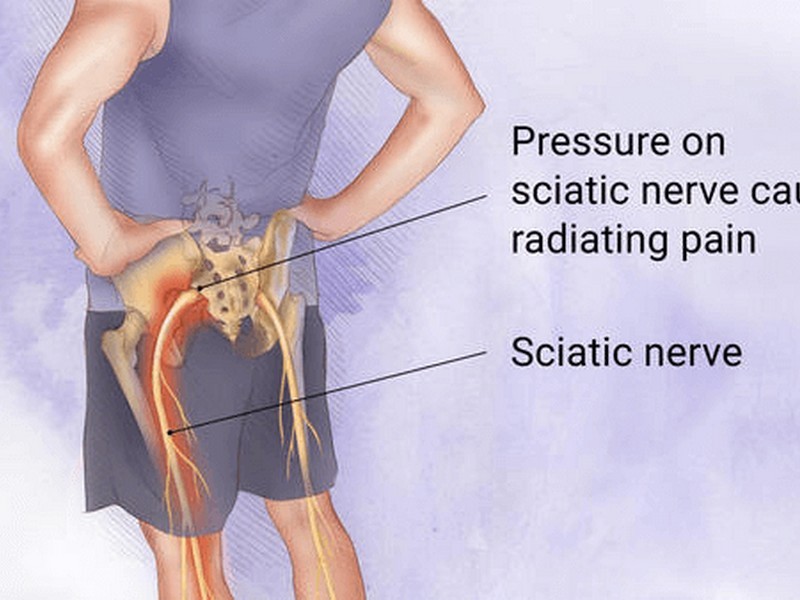Herniated Disc Merrimac Chiropractor Near Me